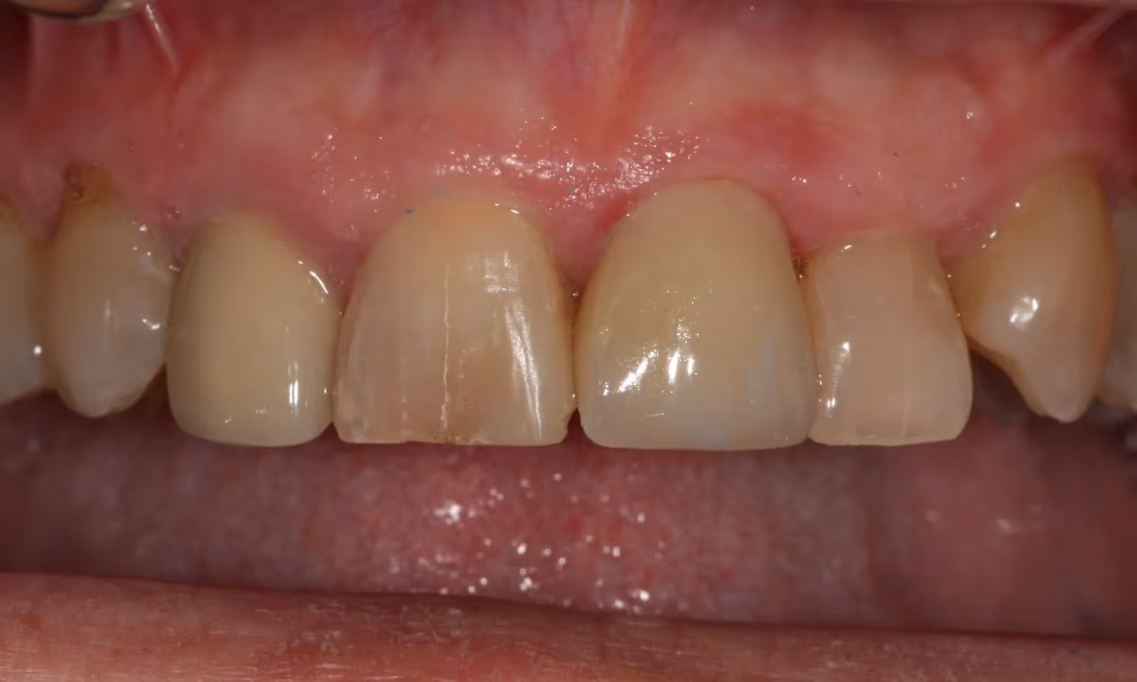 After Image