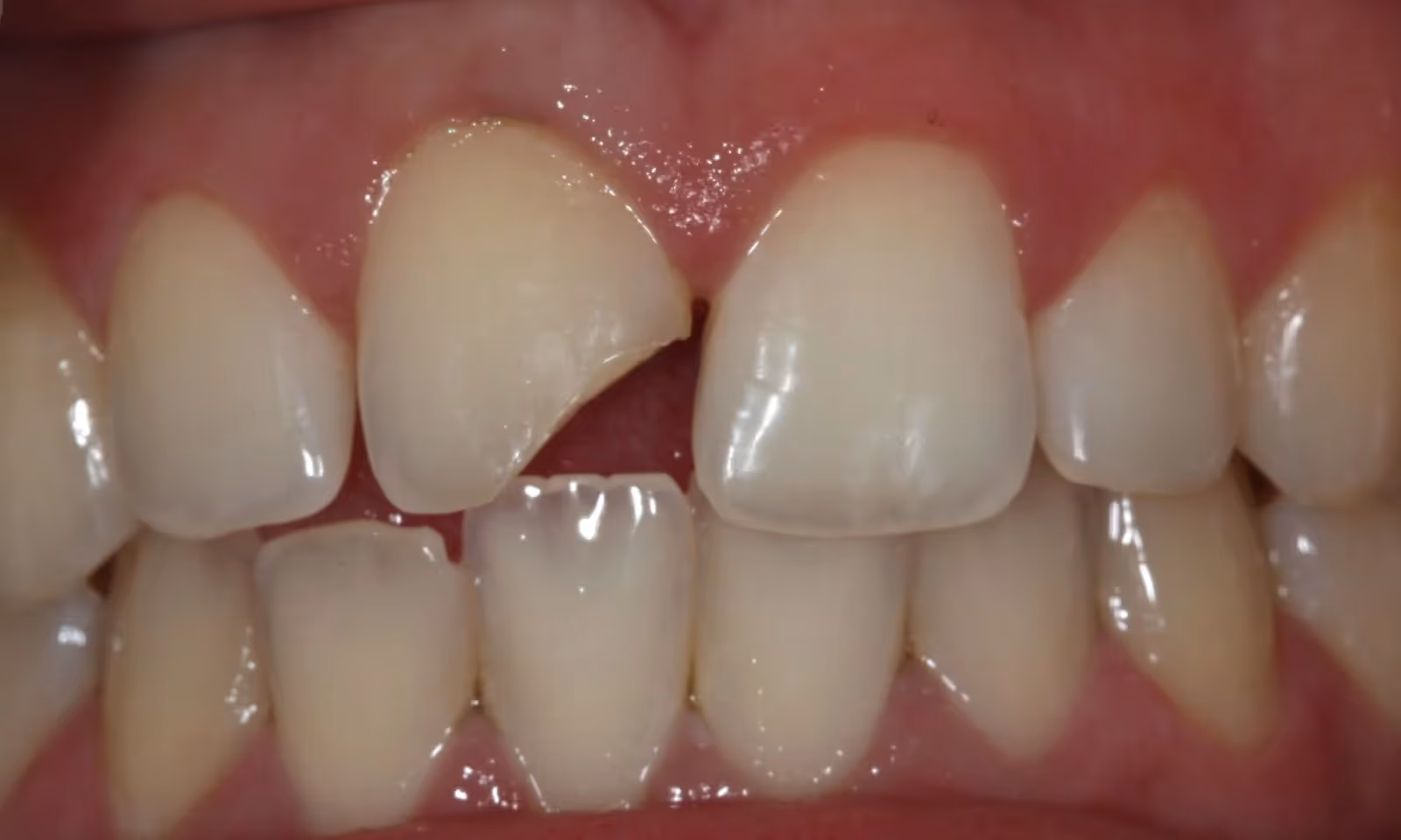 Before Image