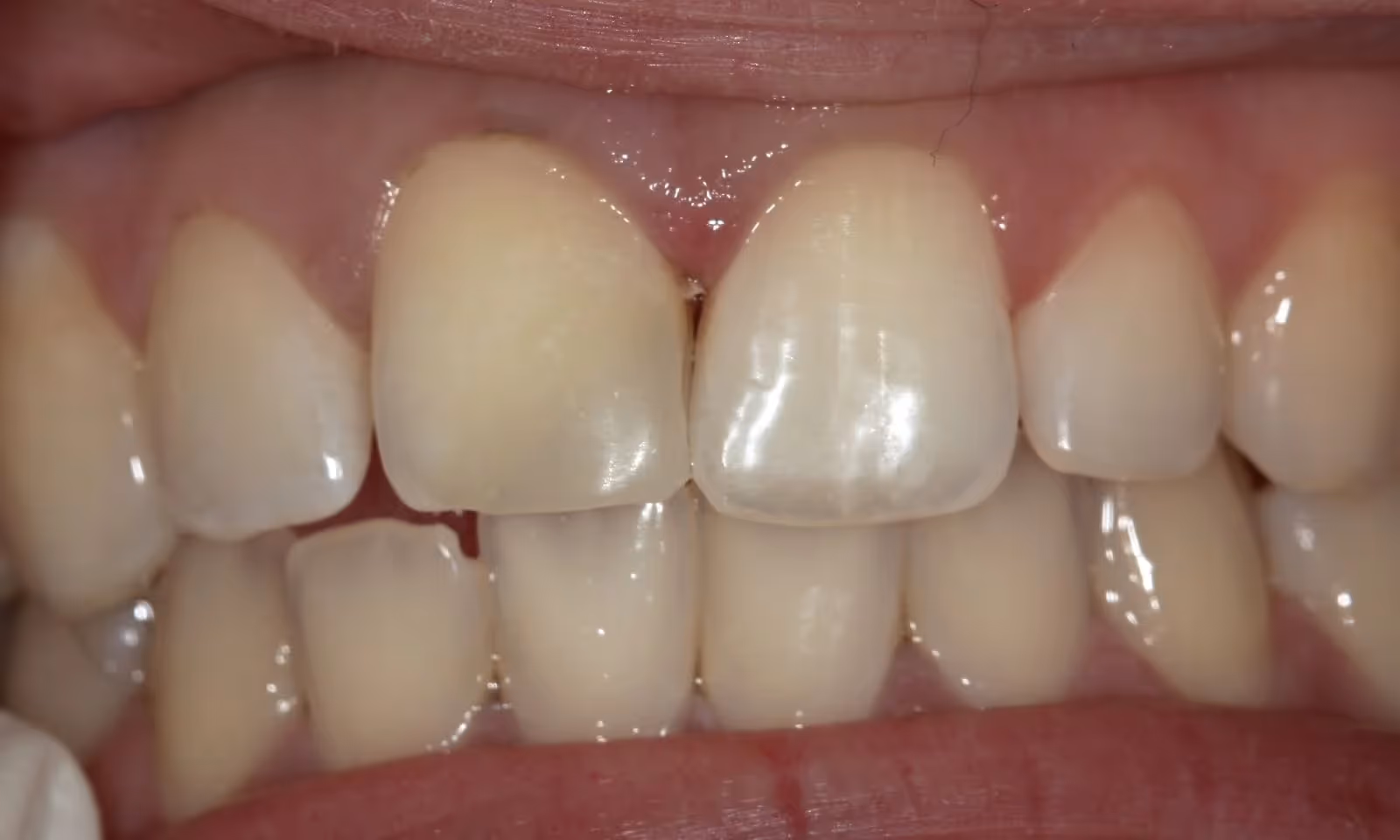 After Image