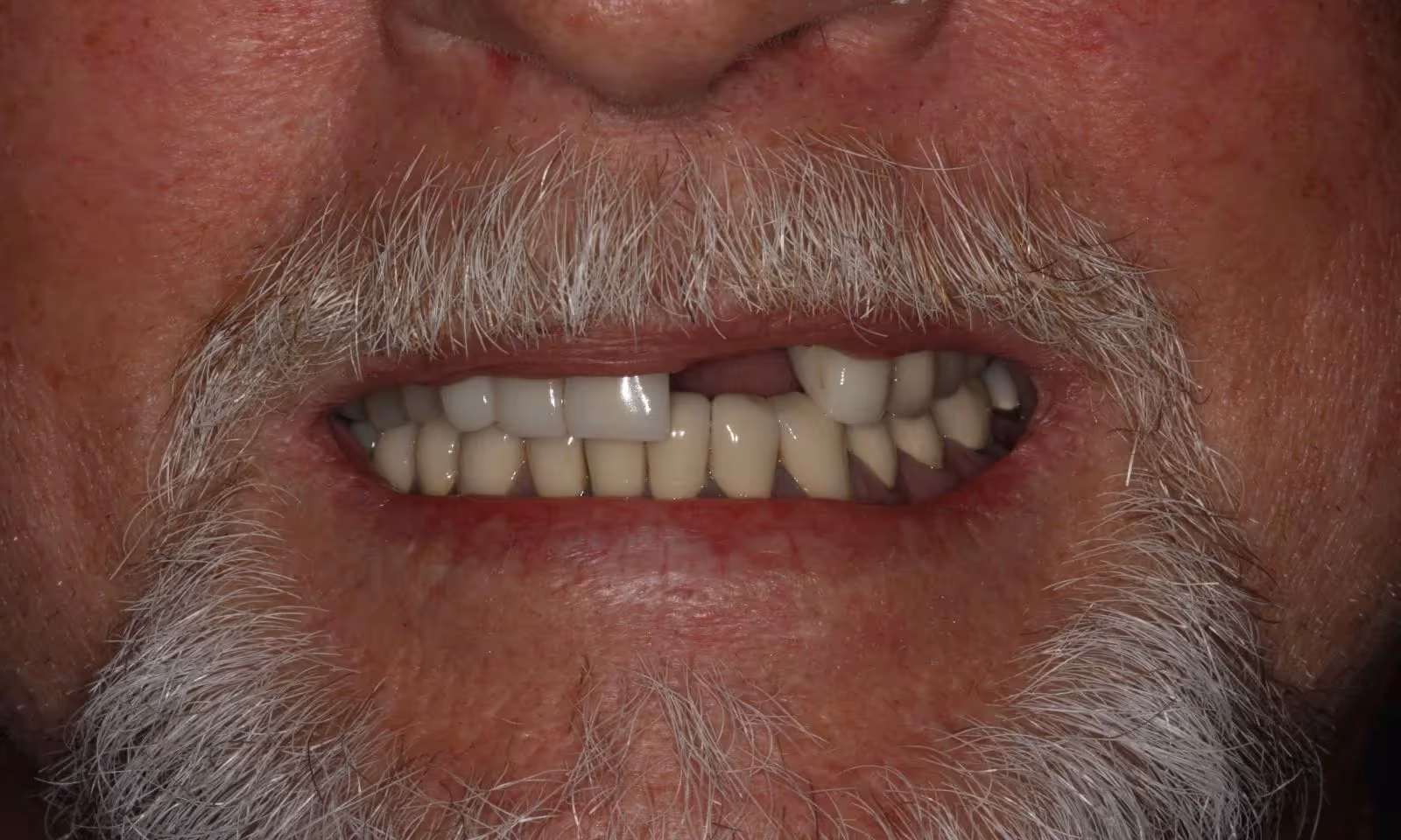 Before Image