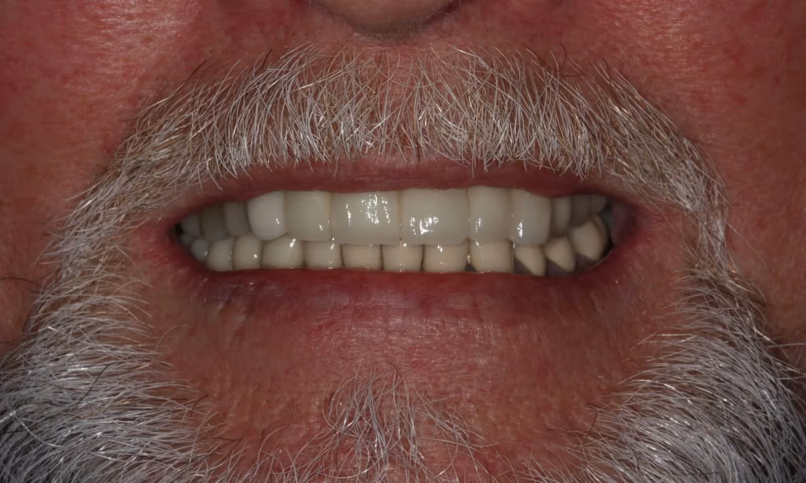 After Image