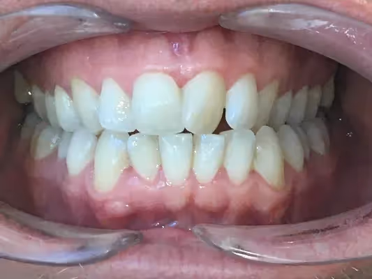 Before Image