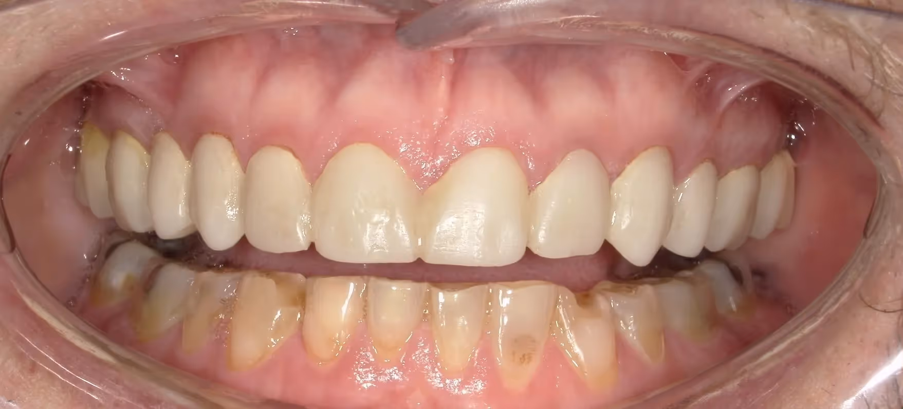 Before Image