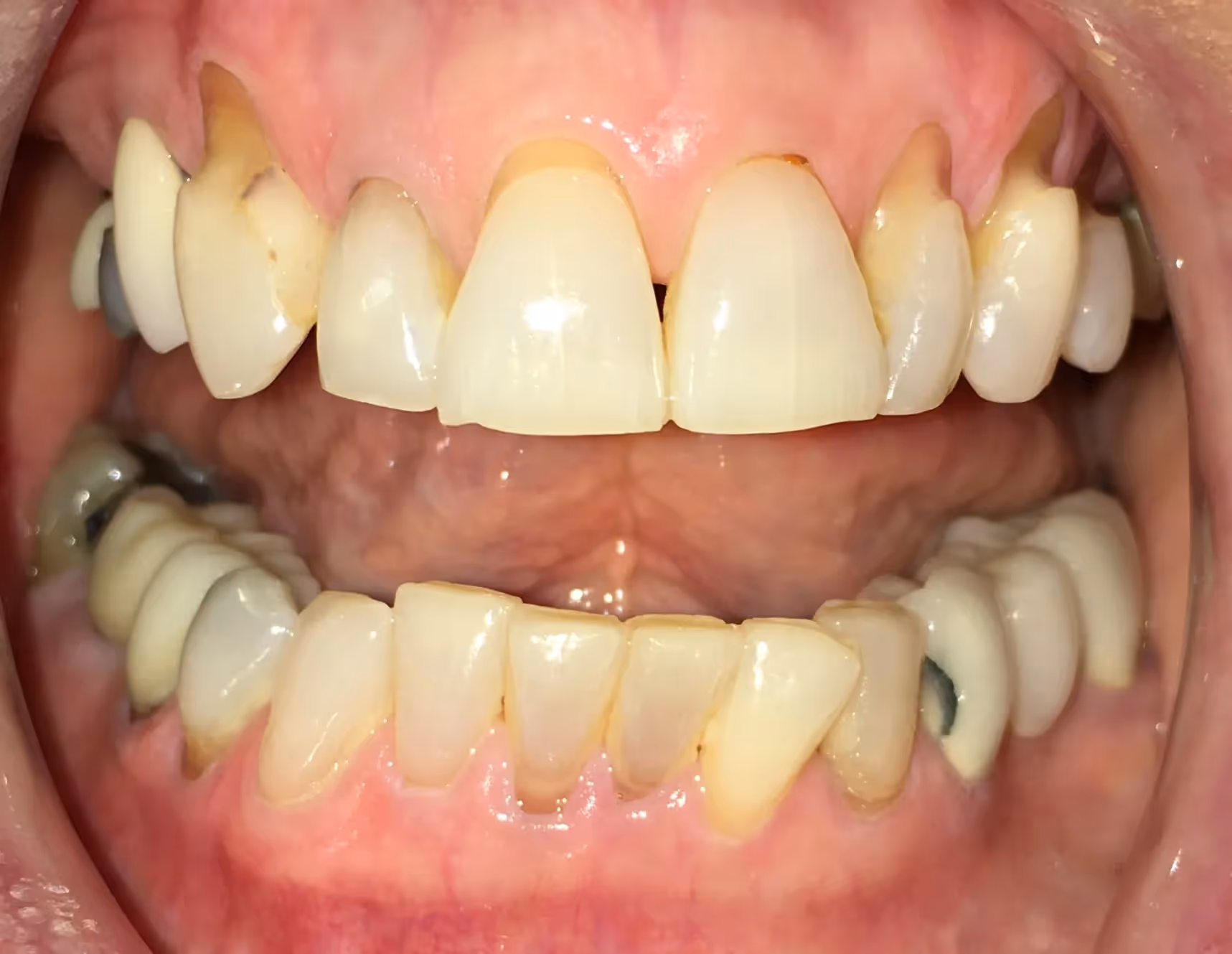 Before Image