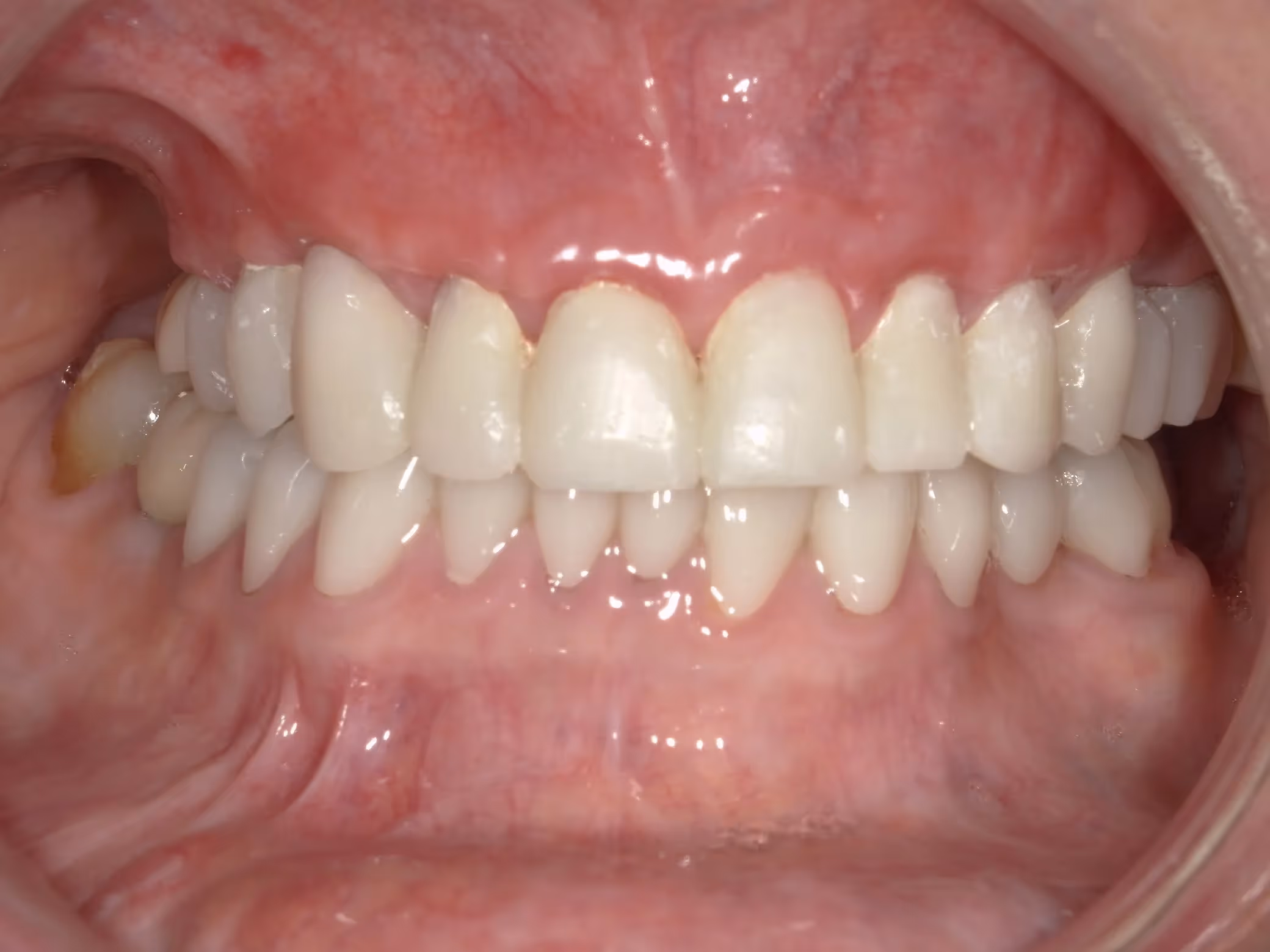 After Image