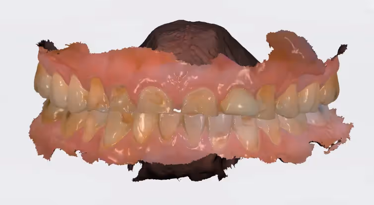 Before Image