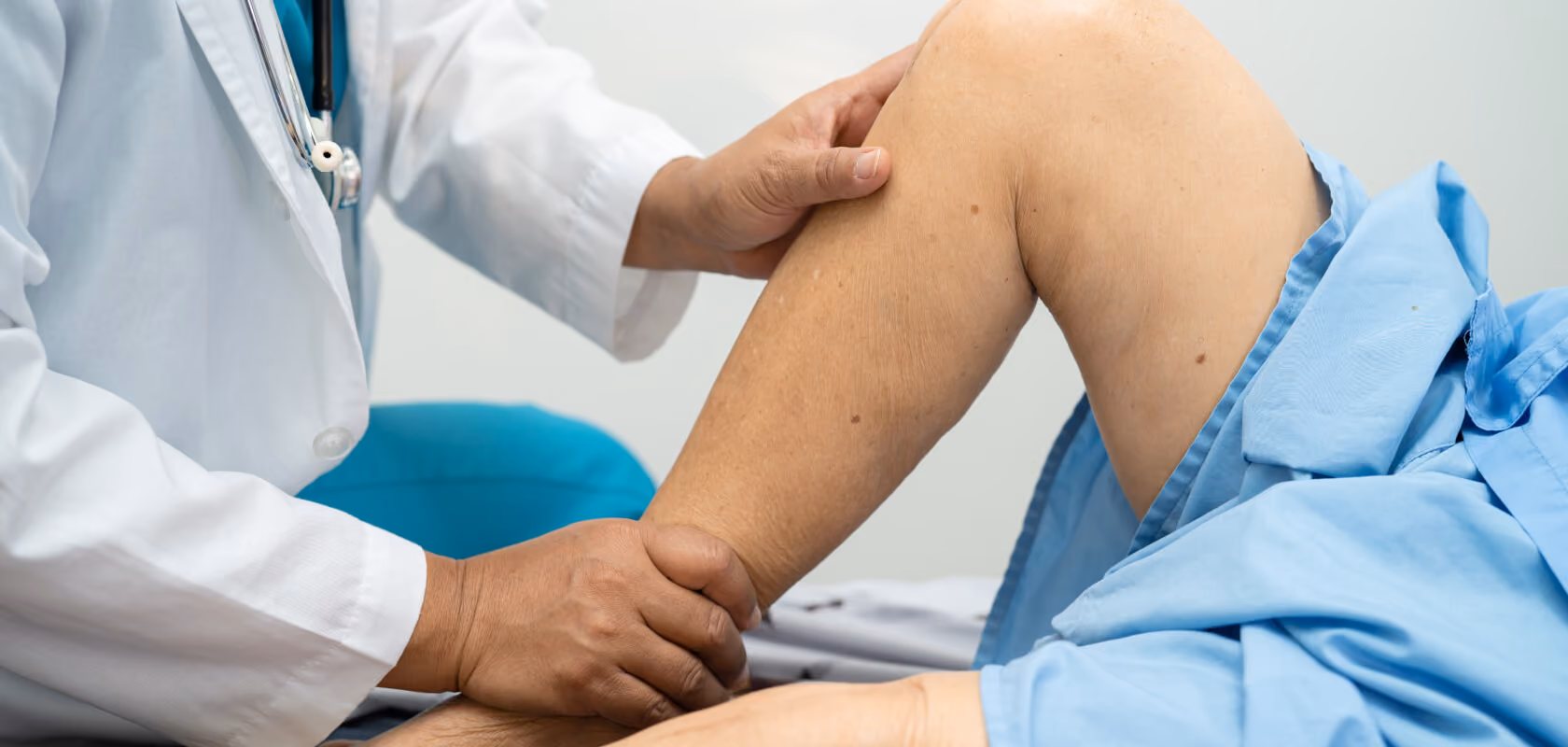 Doctor evaluating a patient's leg for varicose veins.
