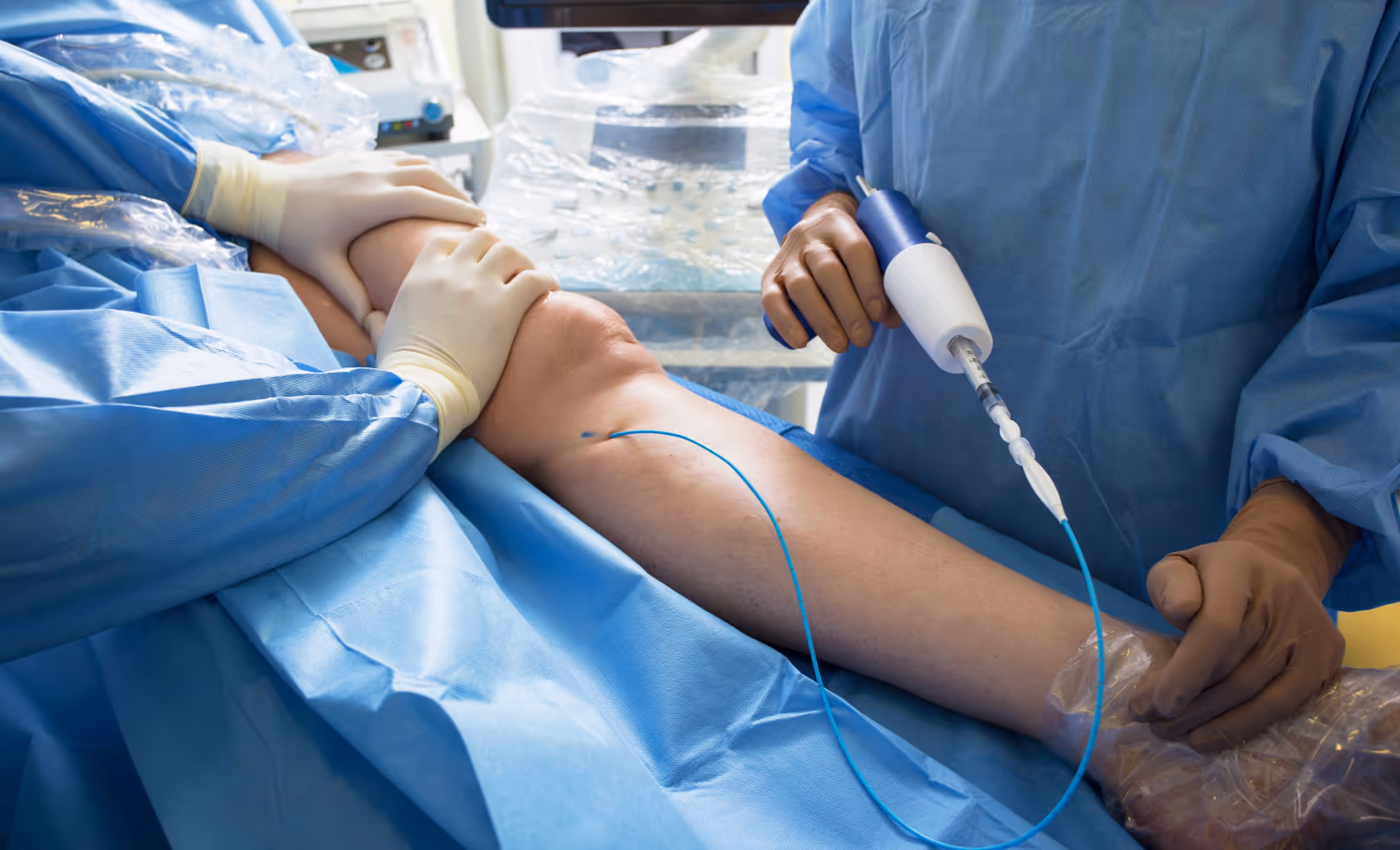 Medical professionals in blue surgical gowns performing catheter vein surgery on a patient's leg.