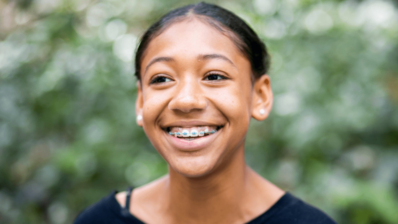 Orthodontics for Teens