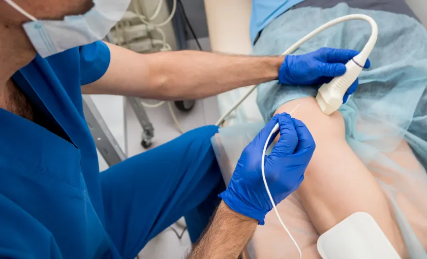 ein specialist performing radiofrequency ablation therapy at BASS Vein Center in Walnut Creek.