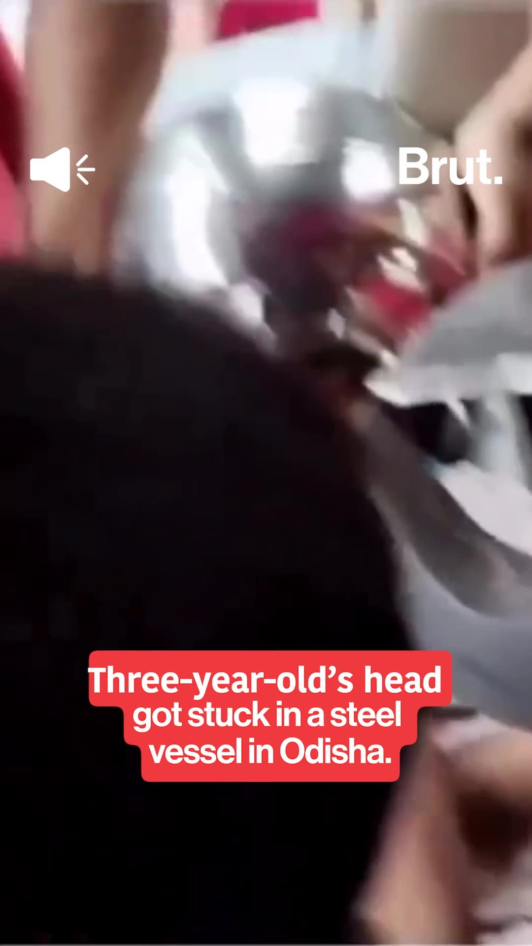 baby-s-head-stuck-in-vessel
