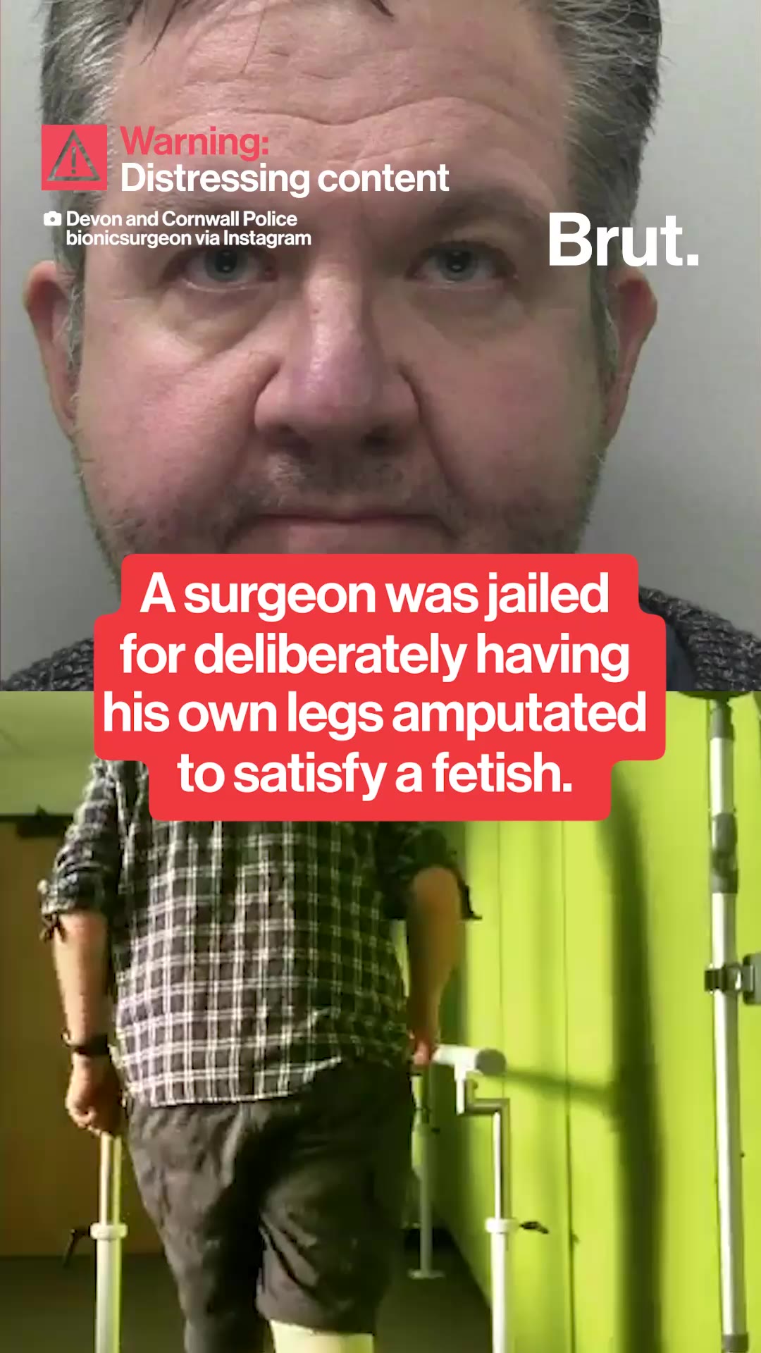 A surgeon amputated his own feet for his sexual fetish.