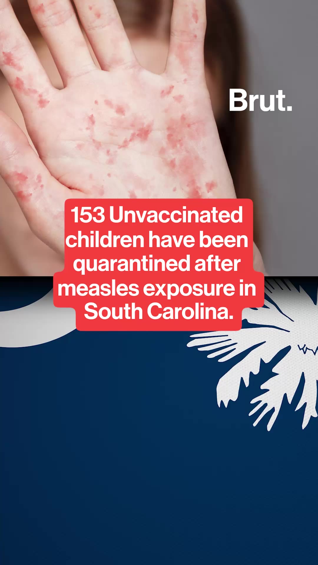 153 unvaccinated kids quarantined amidst measles outbreak in South Carolina.