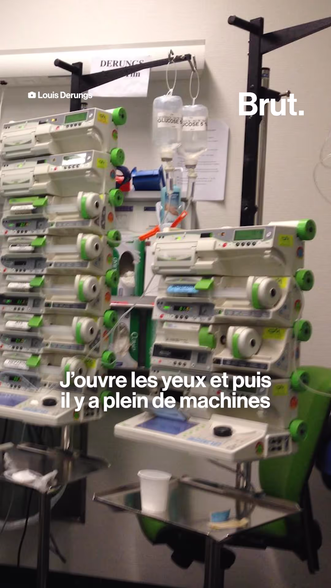 rencontre-avec-un-miracule-victime-d-une-electrocution-de-15-000-volts