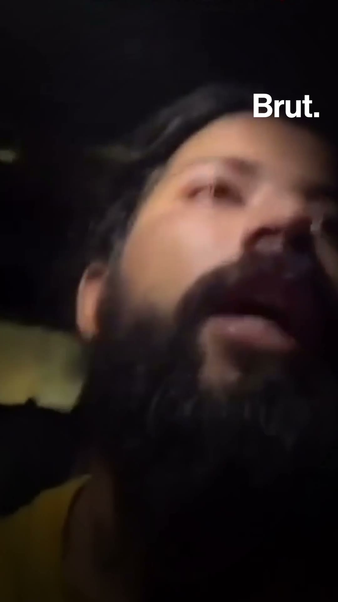 Anurag Dobhal on live stream being getting in an accident