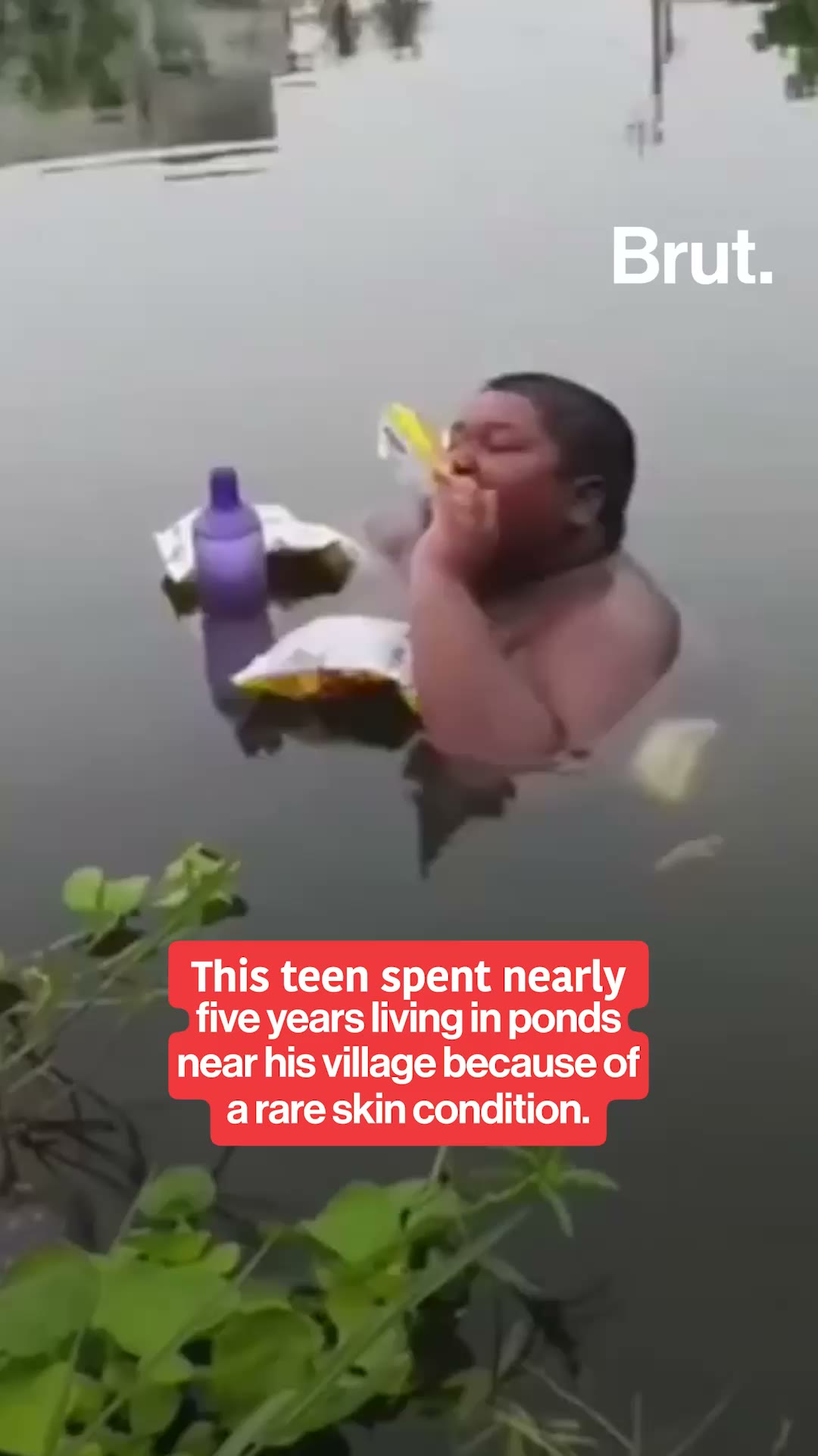 17-year-old rescued from a village pond to receive medical care