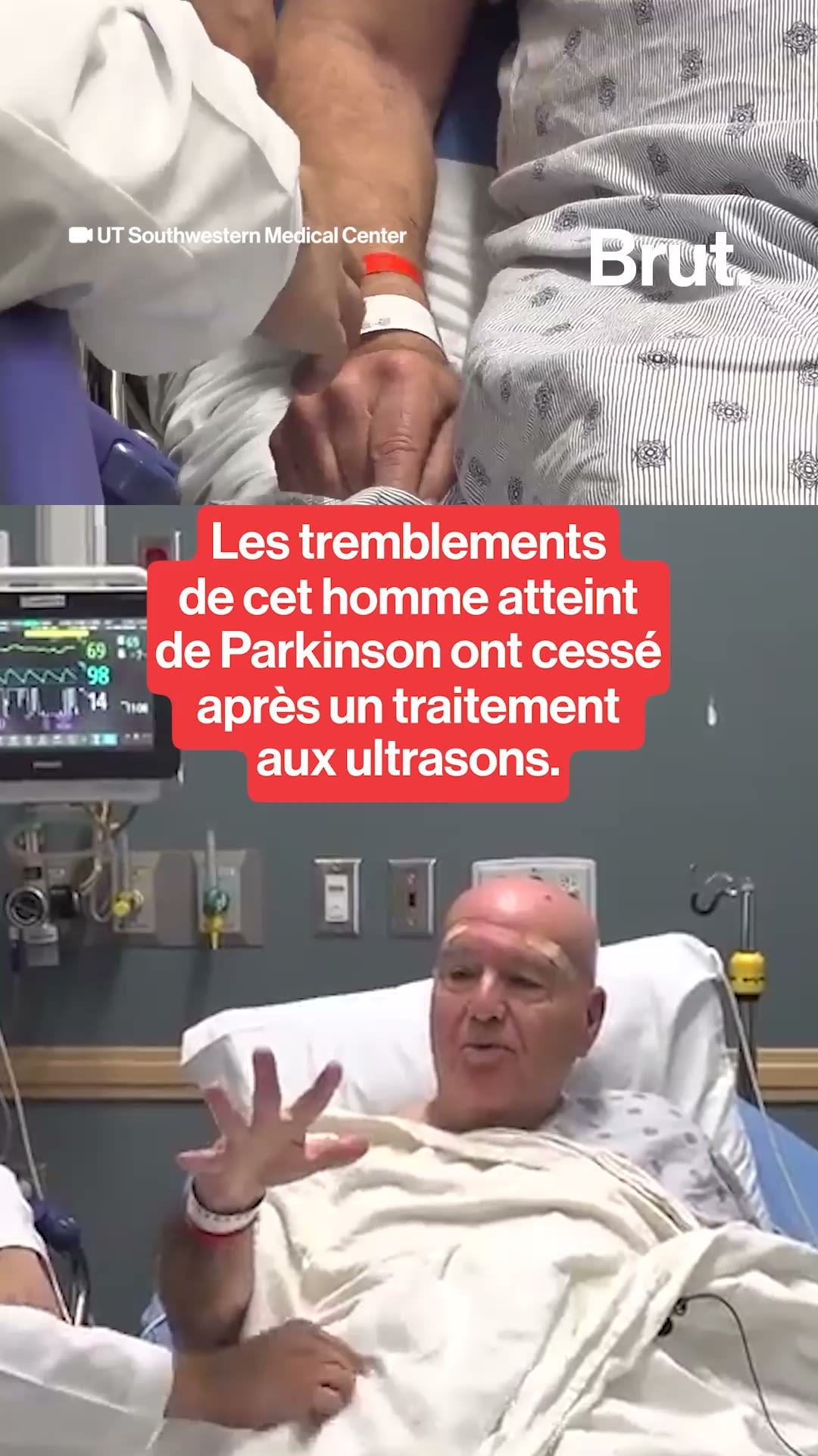 les-tremblements-de-cet-homme-atteint-de-parkinson-ont-cesse-apres-un-traitement-aux-ultrasons