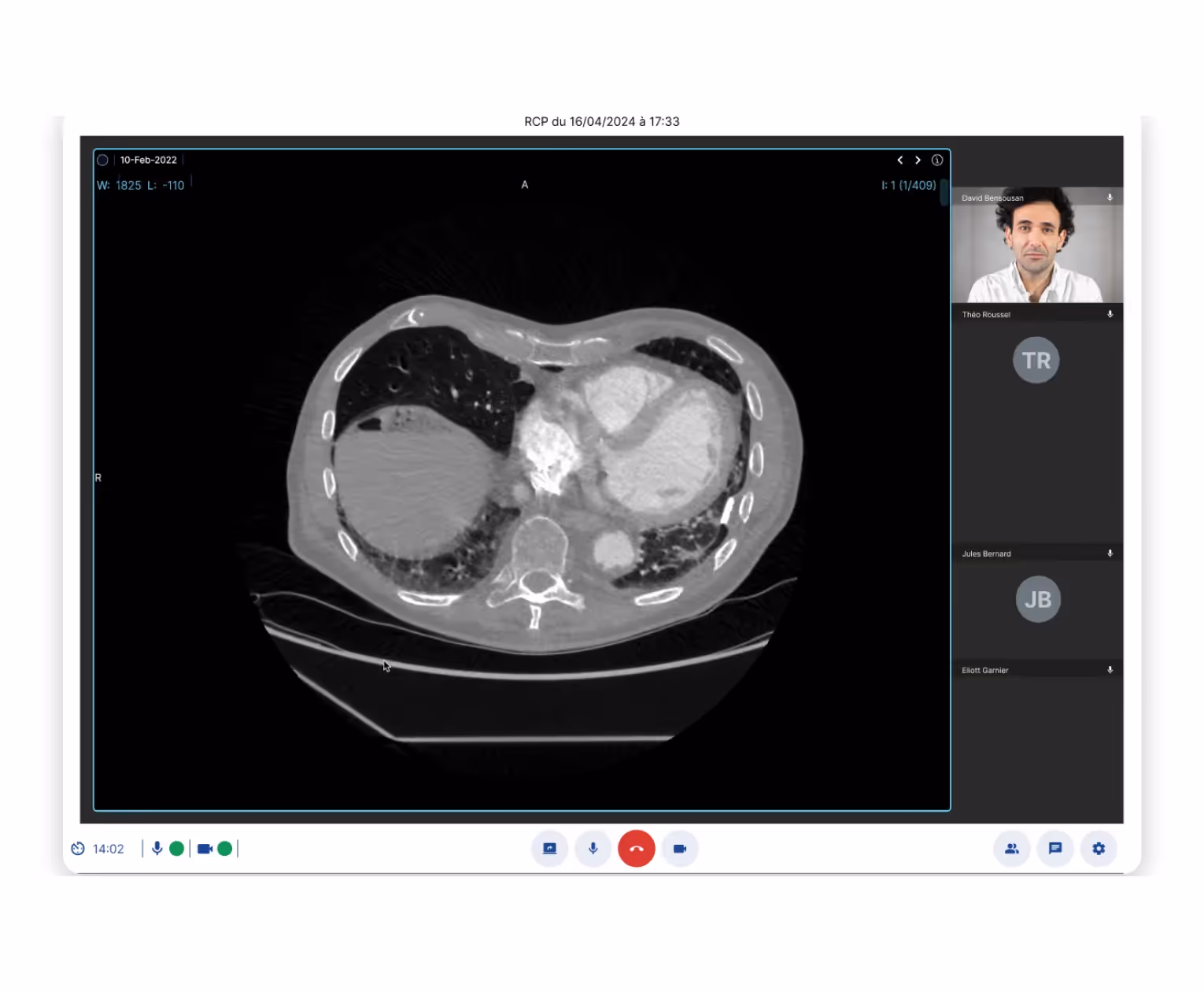 Capture d’écran d’une e-RCP montrant des professionnels de santé qui échangent autour d’une imagerie médicale.
