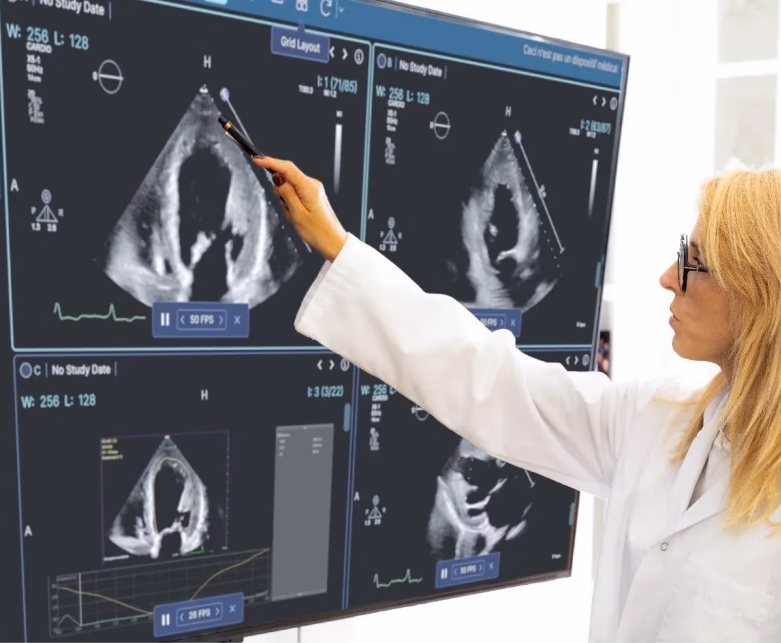 Médecin spécialiste analysant une imagerie médicale lors d’une réunion de concertation pluridisciplinaire (RCP).