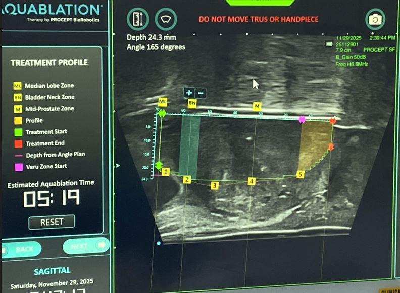 Who Is Aquablation Suitable For? Patient Selection, Prostate Size, and Surgical Experience