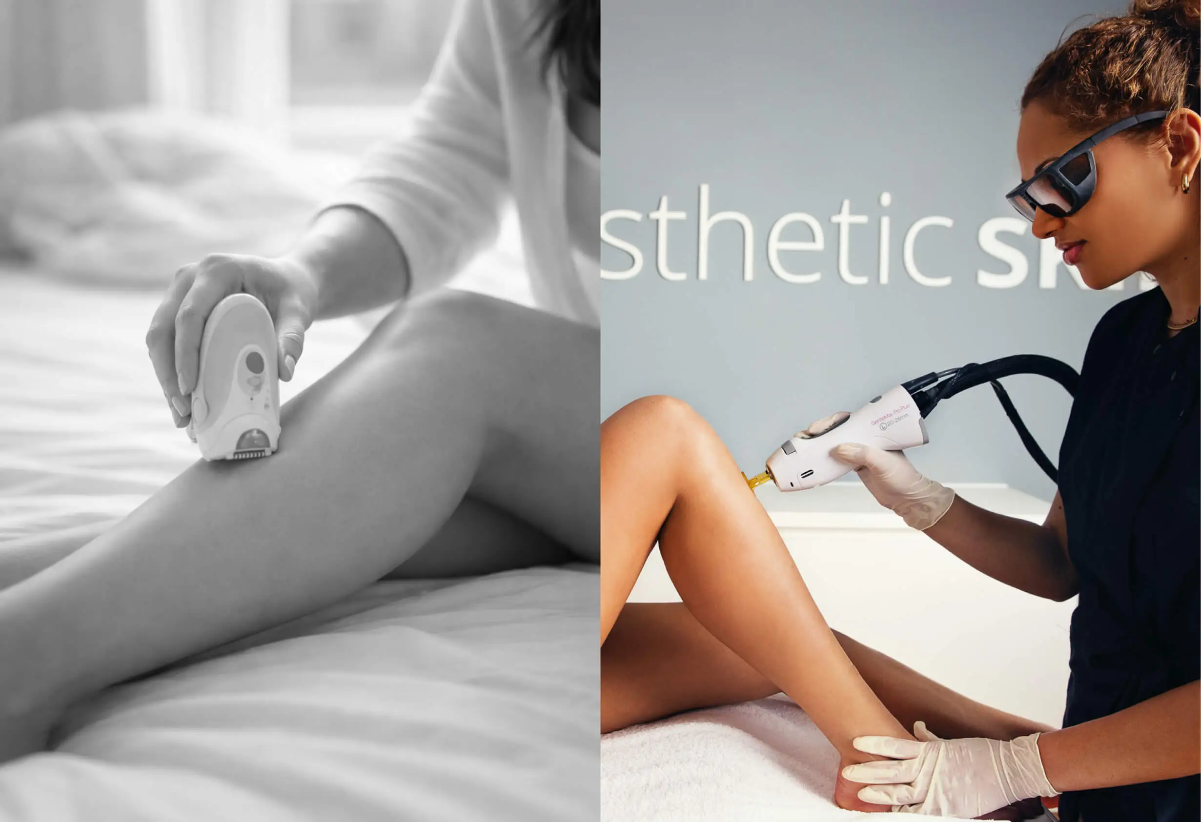 Links person entfernt mit einem Epilierer Haare vom Bein zu Hause, rechts Fachkraft führt dauerhafte Haarentfernung mit IPL-Gerät in Klinik durch.