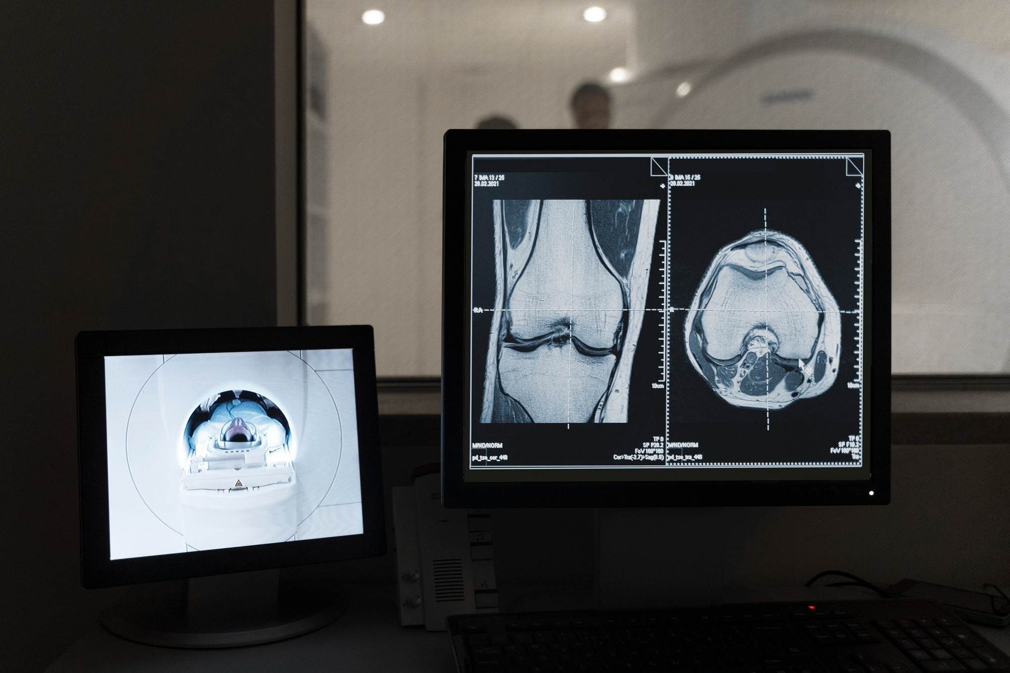 MRI images displayed on a radiology workstation