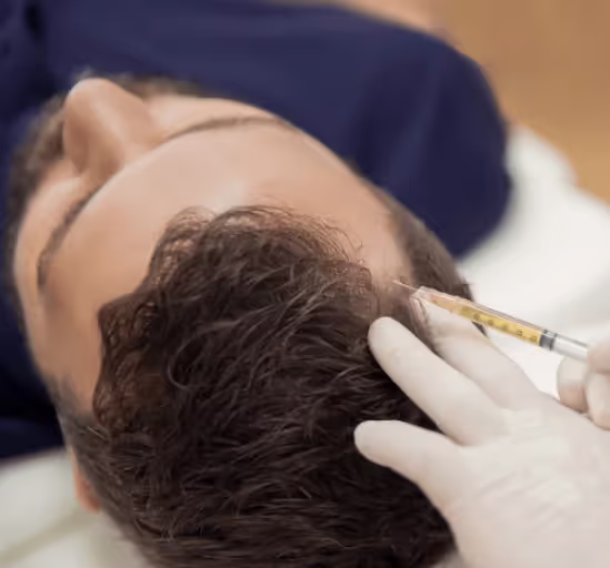 Revitalize Your Scalp with GFC and Mesotherapy at Uncover