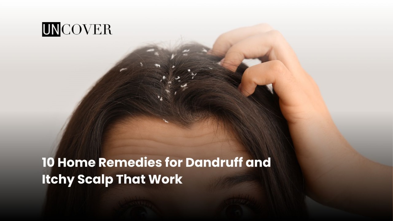 10 Home Remedies for Dandruff and Itchy Scalp That Work