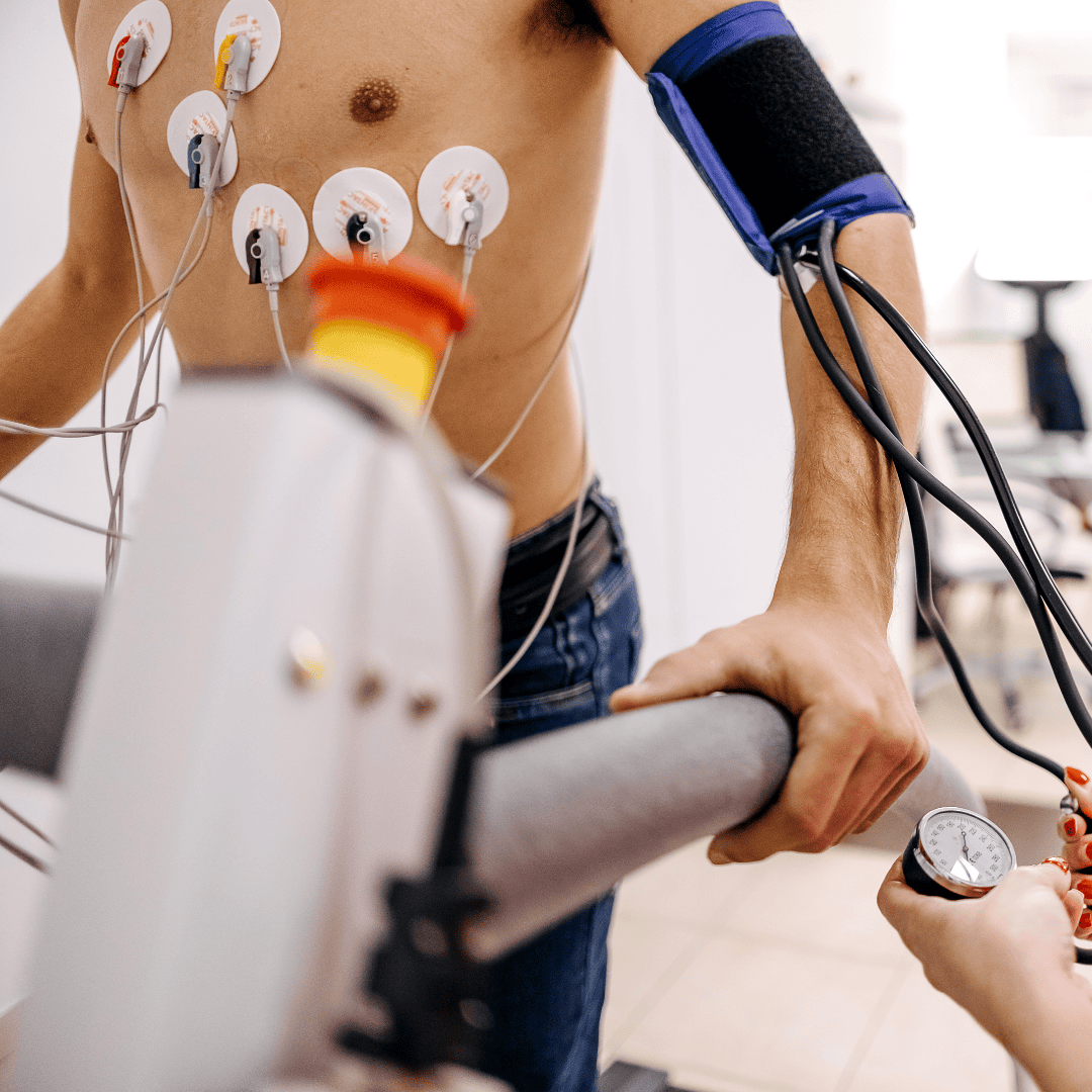 Cardiac Exercise Tolerance Test