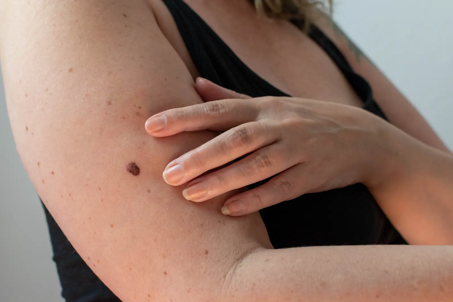 Moles
