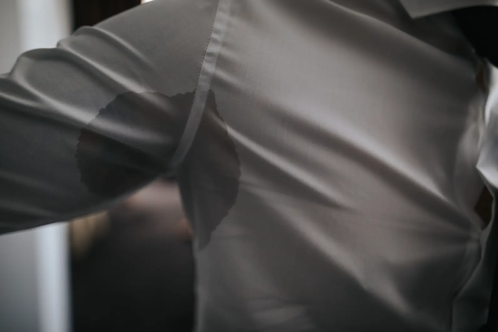 Excessive Sweating (Hyperhidrosis)