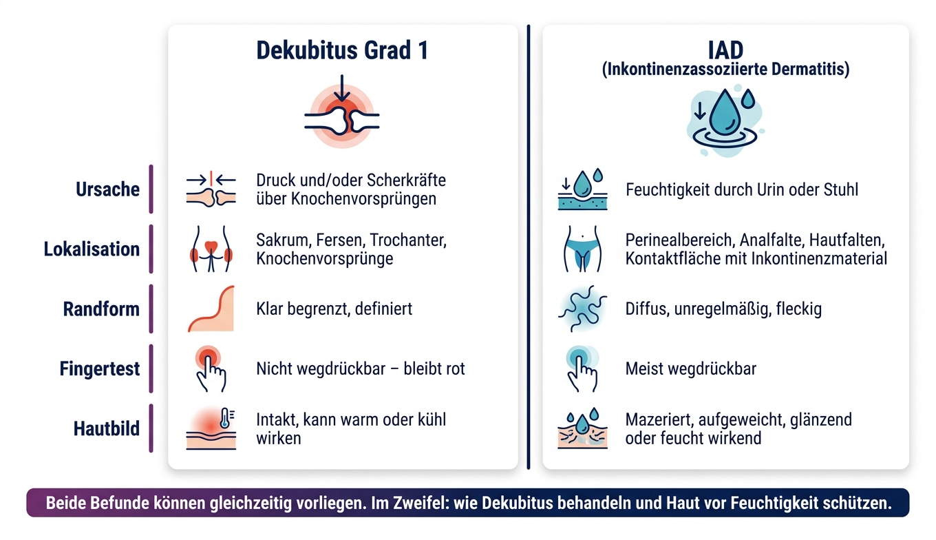 Dekubitus Grad 1 vs. IAD: Unterschiede auf einen Blick