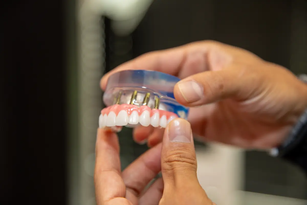 All on X / Permanent Teeth