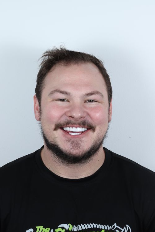 porcelain veneers photo. GR Dents Patient. Porcelain Veneers in Colombia