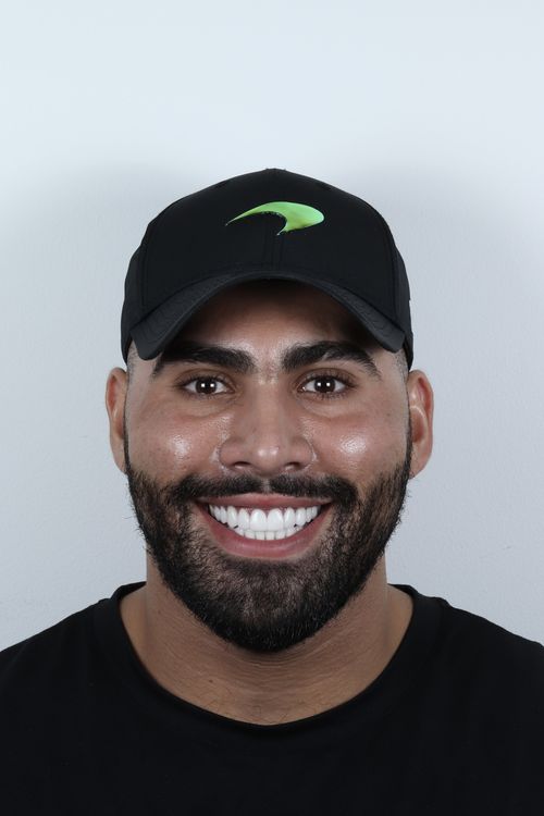 porcelain veneers photo. GR Dents Patient. Porcelain Veneers in Colombia