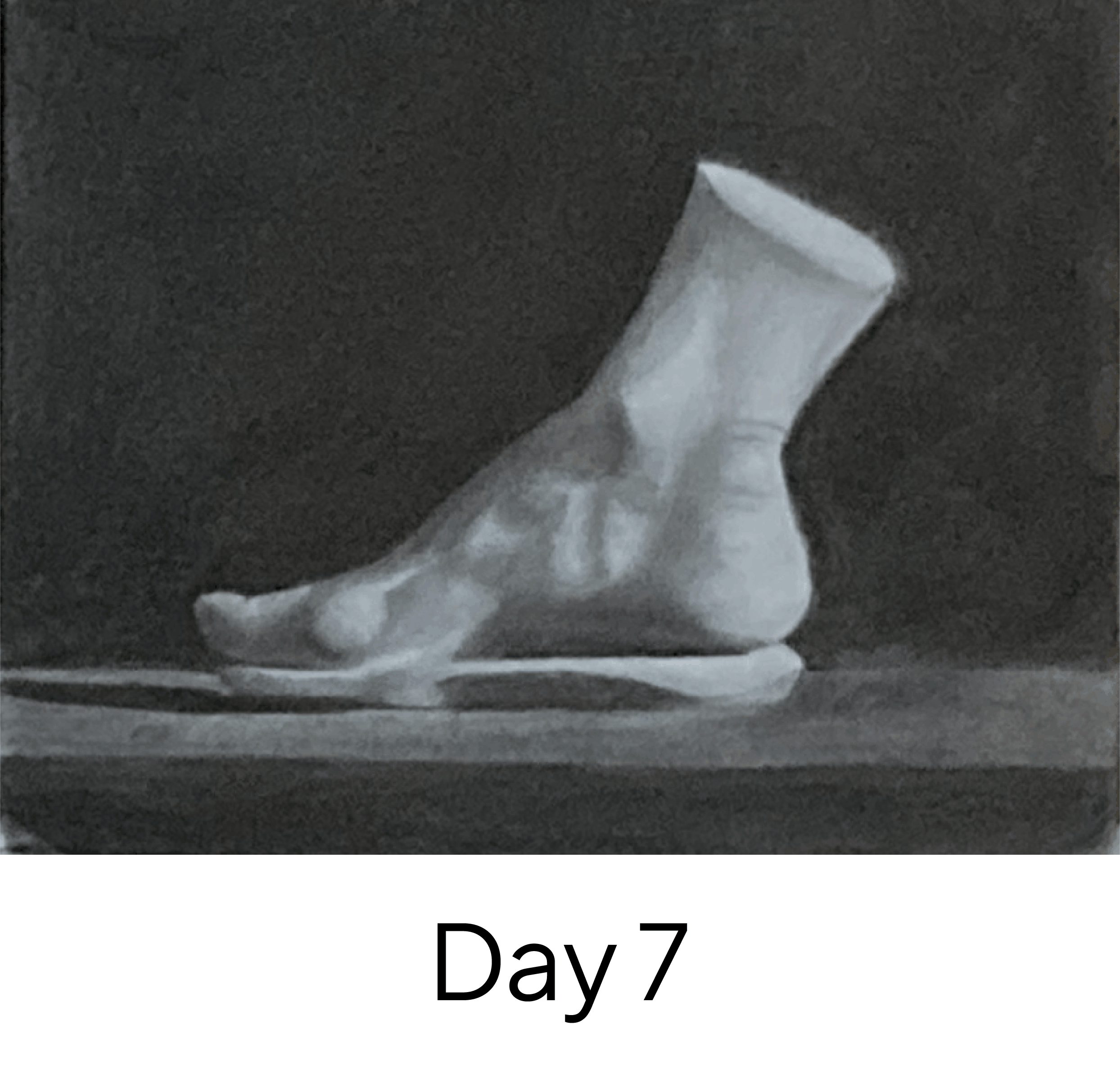 Day 7