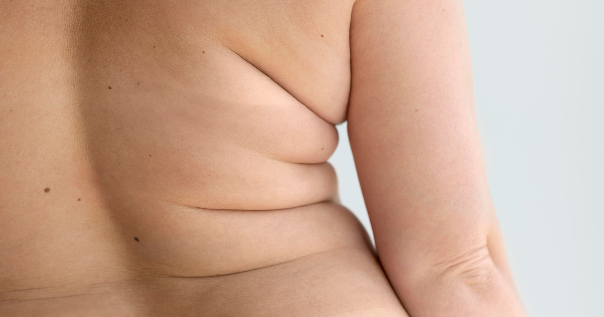 Metabolismo, inflamação e retenção de líquidos afetam seu corpo e pele