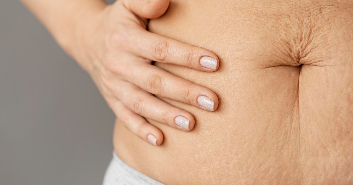 O que muda na pele pós-gravidez e como recuperar firmeza