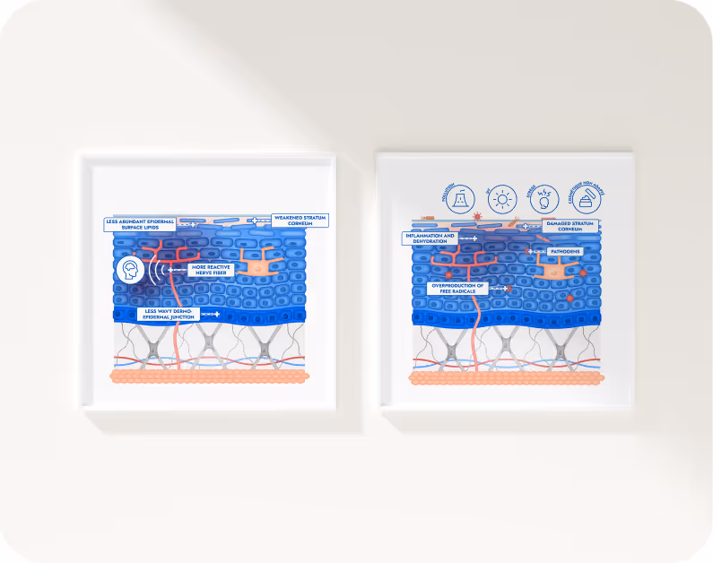 Projet d'illustrations anatomiques pour Mixa : création de diverses coupes de peau sur-mesure.