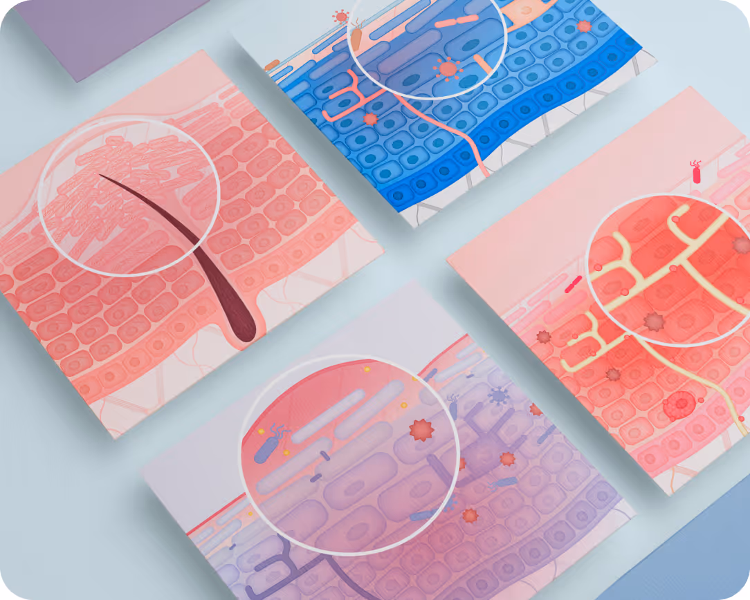 Projet d'illustrations anatomiques pour Mixa : création de diverses coupes de peau sur-mesure.