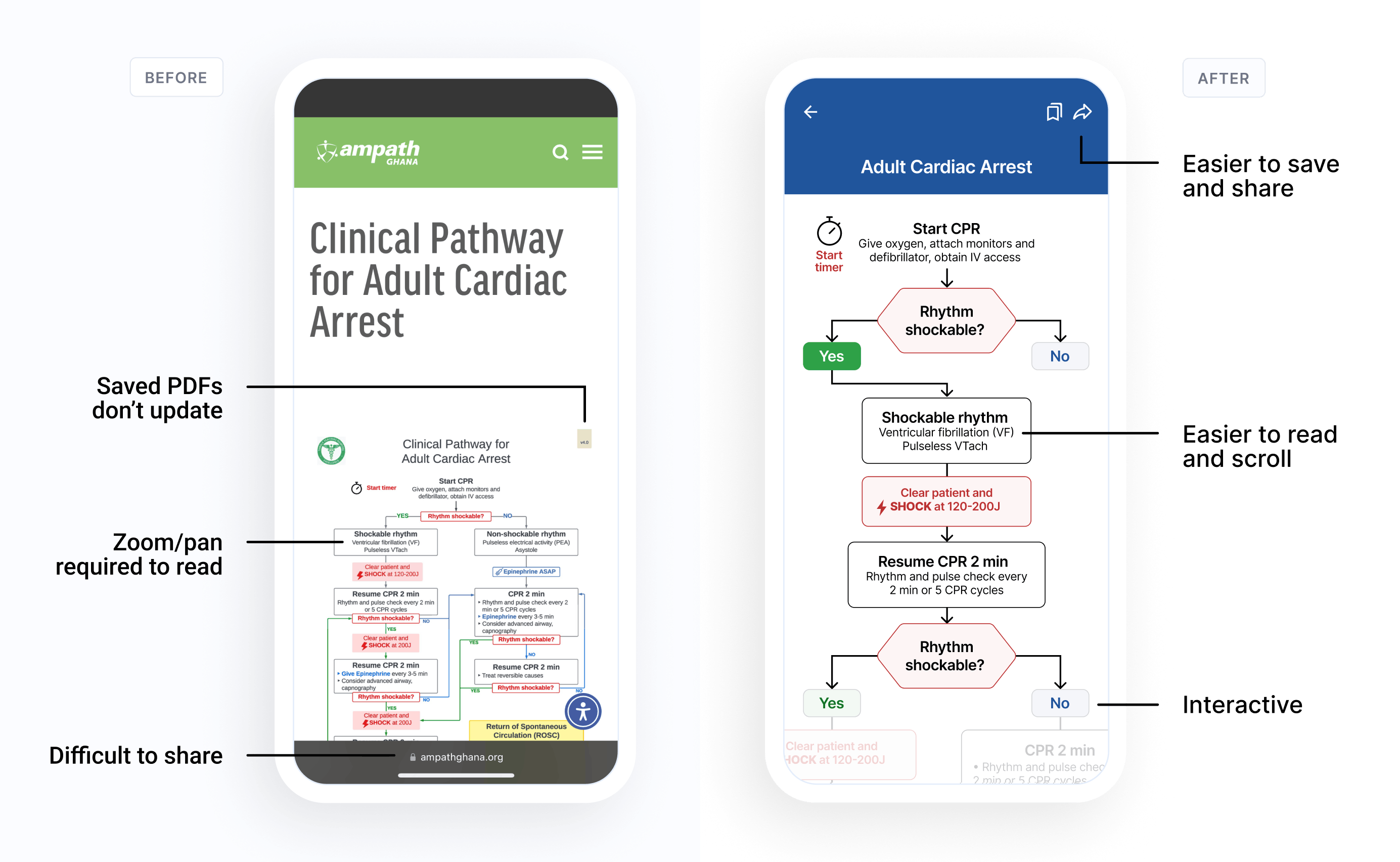 Comparison of two mobile screens showing a clinical pathway for adult cardiac arrest. The left screen labeled 'Before' displays a PDF of the pathway that is difficult to read without zooming and is hard to share, with annotations pointing out 'Saved PDFs don’t update,' 'Zoom/pan required to read,' and 'Difficult to share.' The right screen labeled 'After' shows a clear, interactive flowchart with steps for CPR, rhythm shockability assessment, and actions like administering shocks or epinephrine, designed for ease of use and sharing.