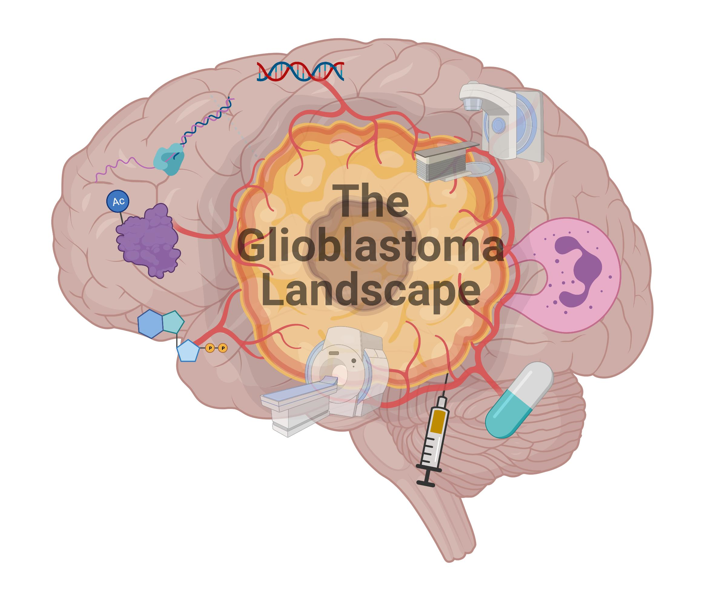 JPM | Free Full-Text | Diagnosis and Management of Glioblastoma: A  Comprehensive Perspective