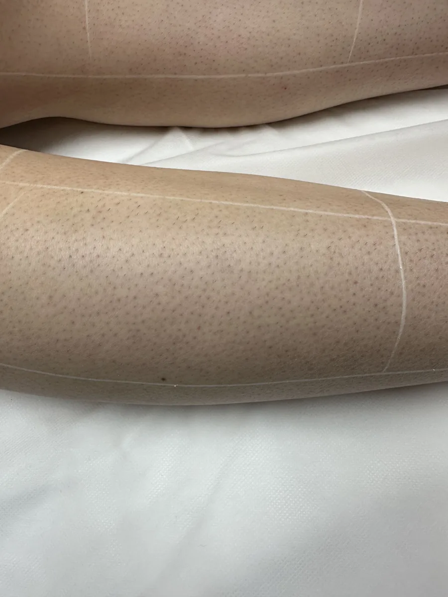Legs before laser hair removal