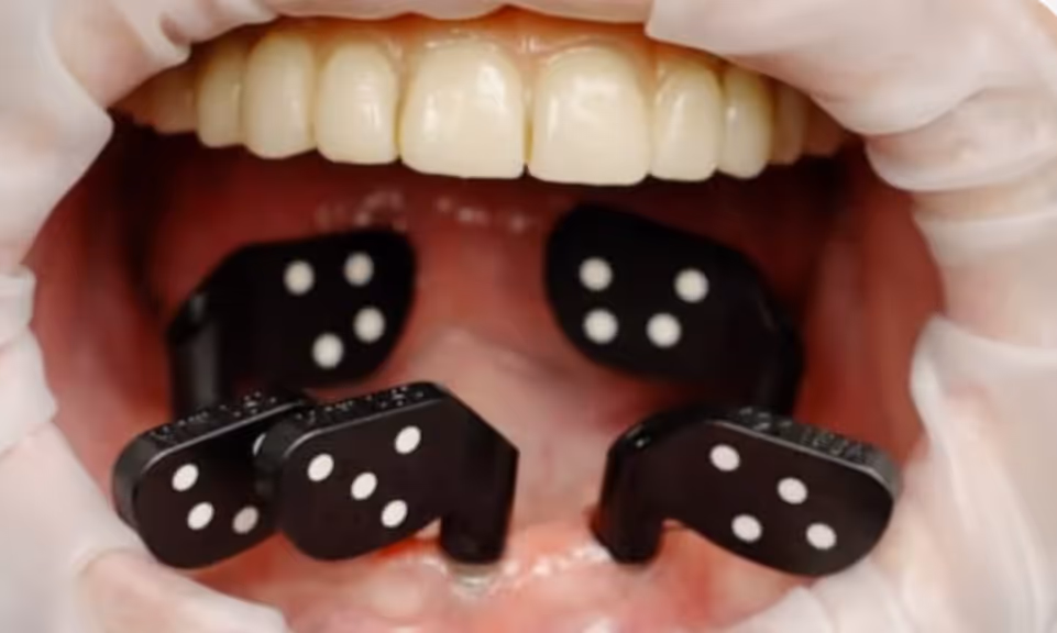 Vertical Sinus Lifts CE Courses