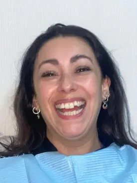 Patricia Aedo antes del tratamiento con alineadores
