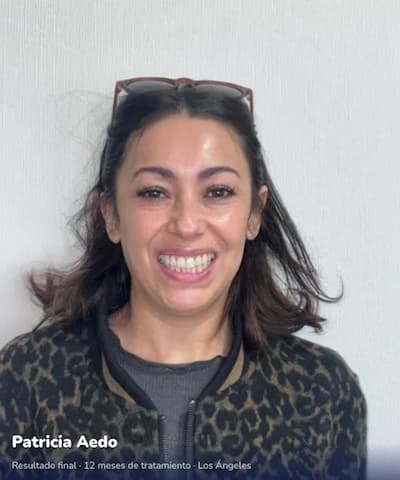 Patricia Aedo — resultado final Isaligner Los Ángeles
