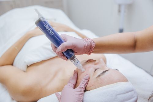 Microneedling before and after results for sun damage and dark spots in Queen Creek, Arizona