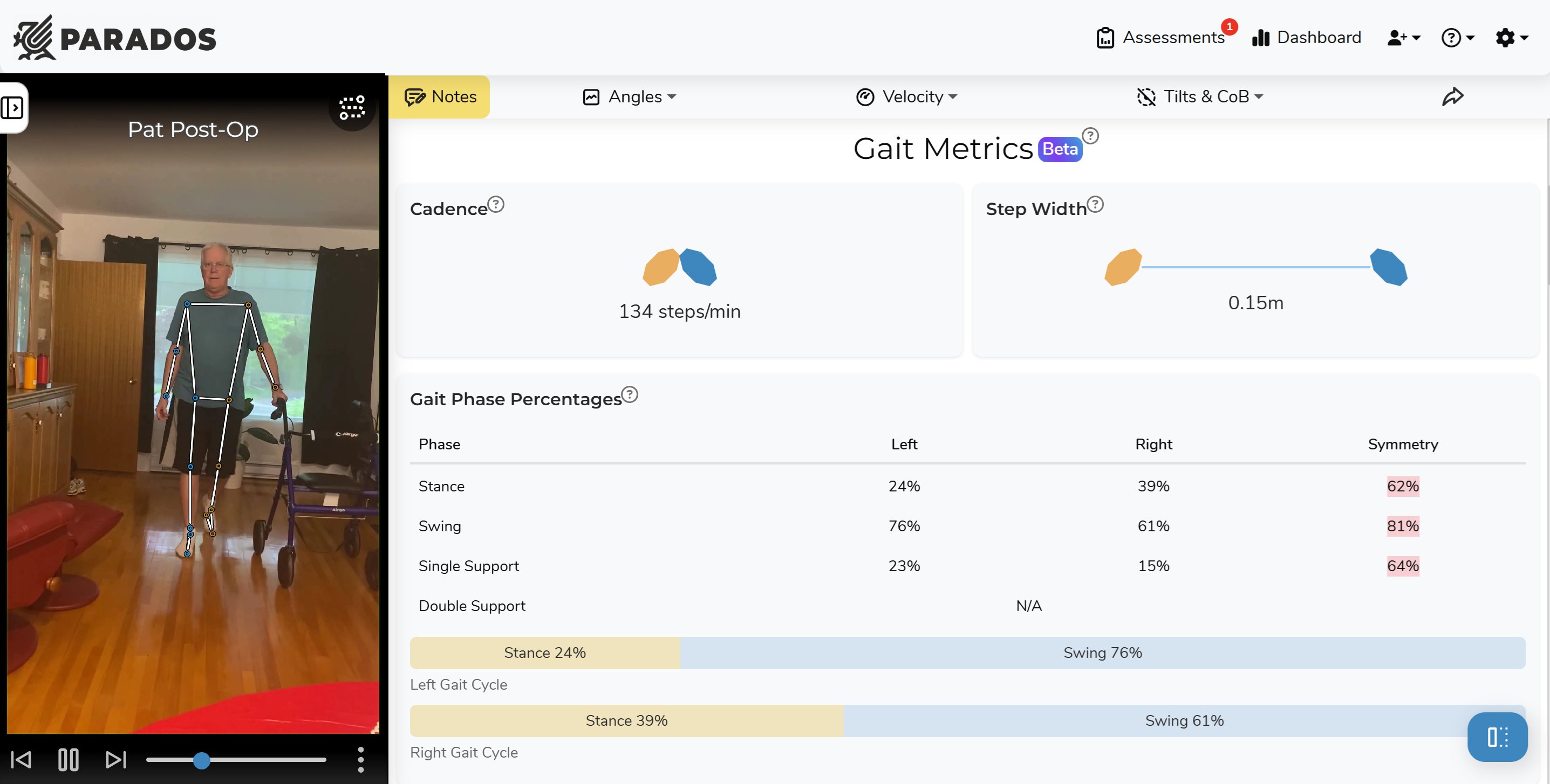 A screenshot of the dashboard where gait analysis metrics are visualzied alongside an older man walking towards the camera with a pose estimation skeleton overlaid on him