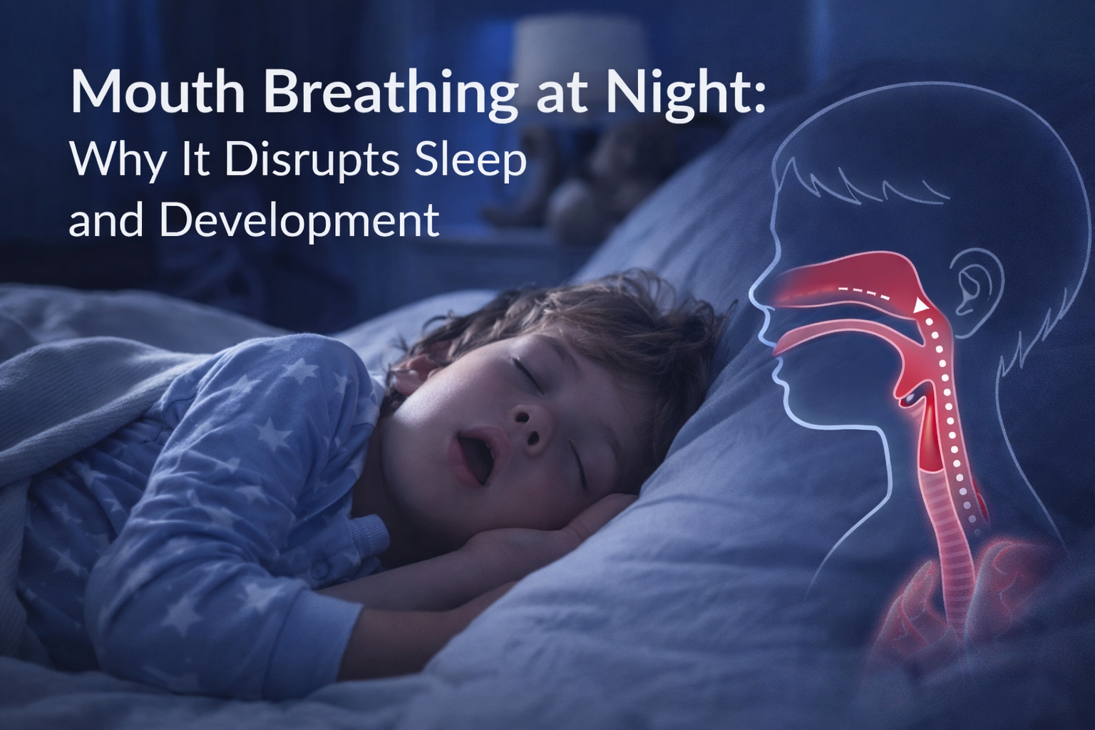 Child sleeping with mouth open at night illustrating how mouth breathing disrupts sleep and development.