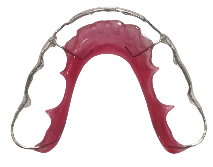 Removable retainers